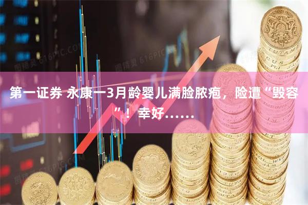 第一证券 永康一3月龄婴儿满脸脓疱，险遭“毁容”！幸好……
